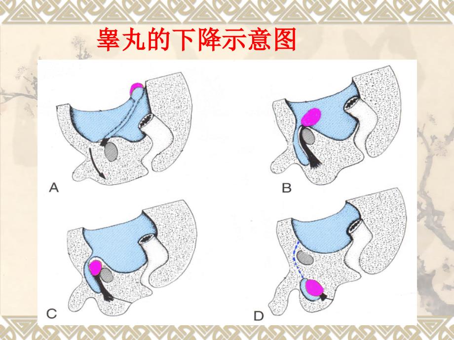 男性生殖系统超声诊断_第4页