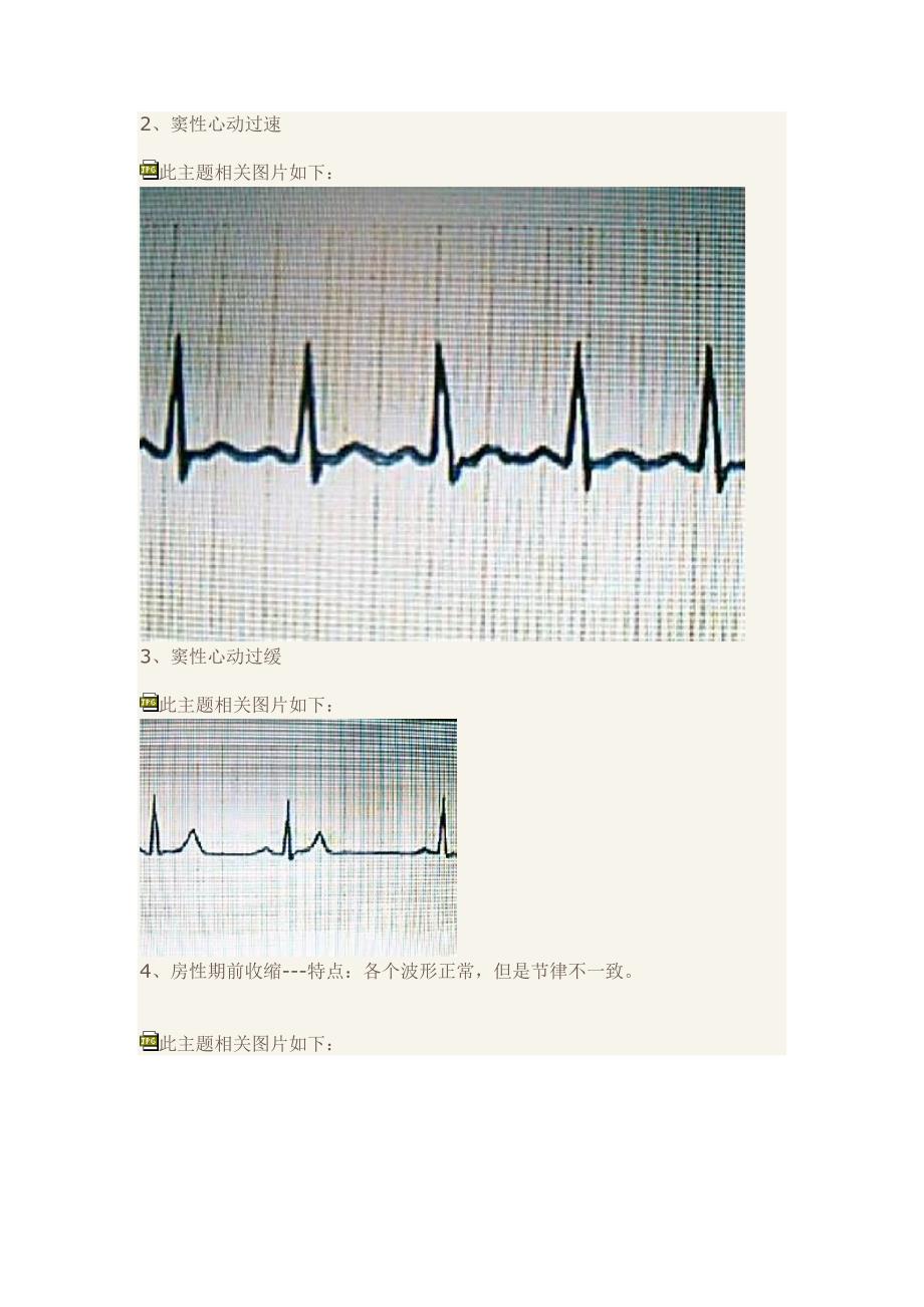 教你快速读懂心电图.doc_第2页