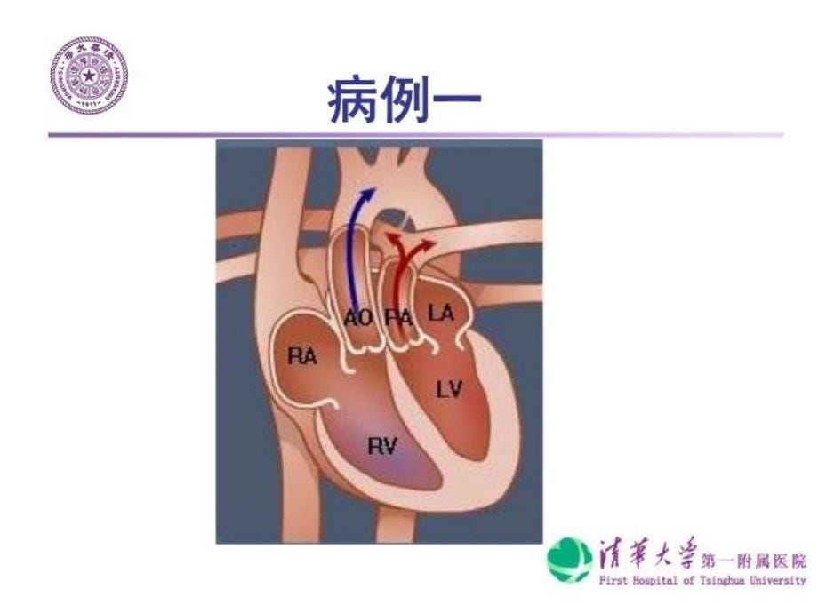 最新心脏外科病例PPT课件_第5页