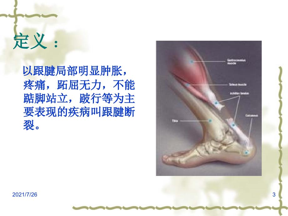 跟腱断裂护理查房课件_第3页