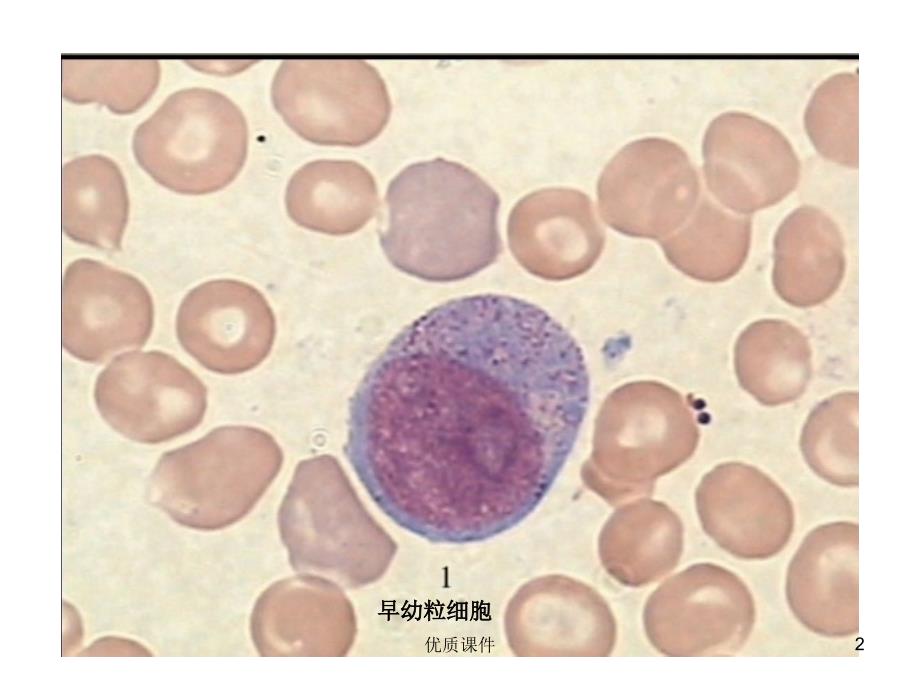 血液学细胞形态学复习(附图片)#上课课堂_第2页