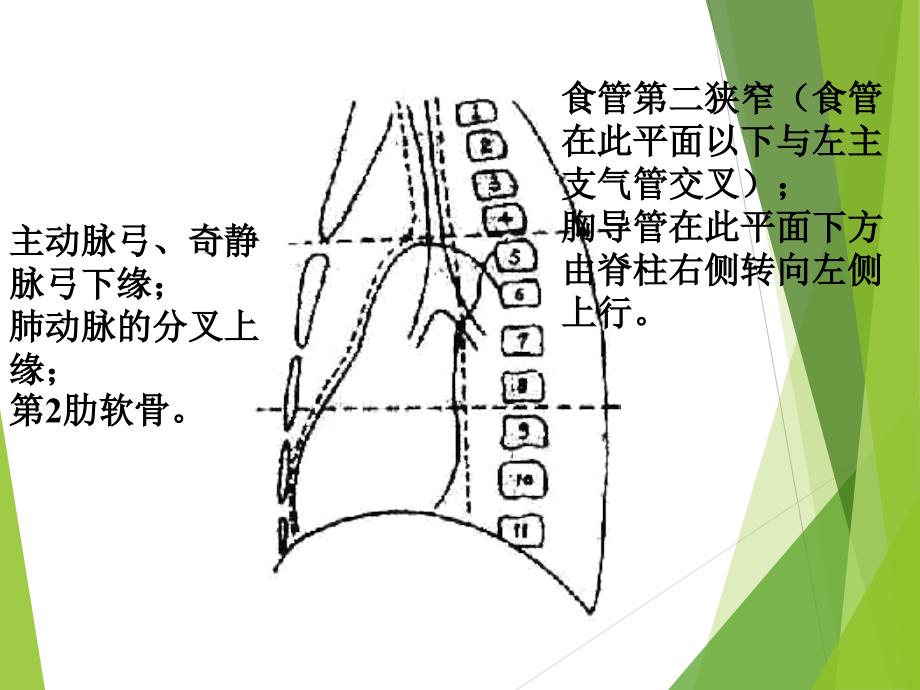 CT纵隔淋巴结分区_第3页