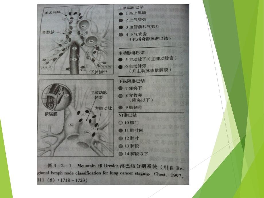 CT纵隔淋巴结分区_第4页