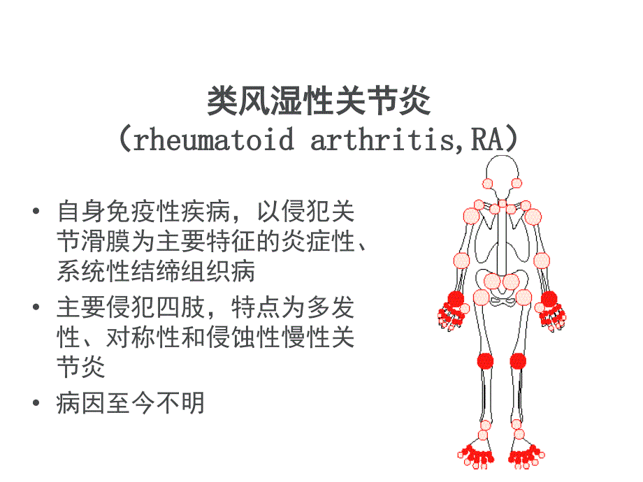 类风湿性炎的影像学诊断ppt课件_第2页