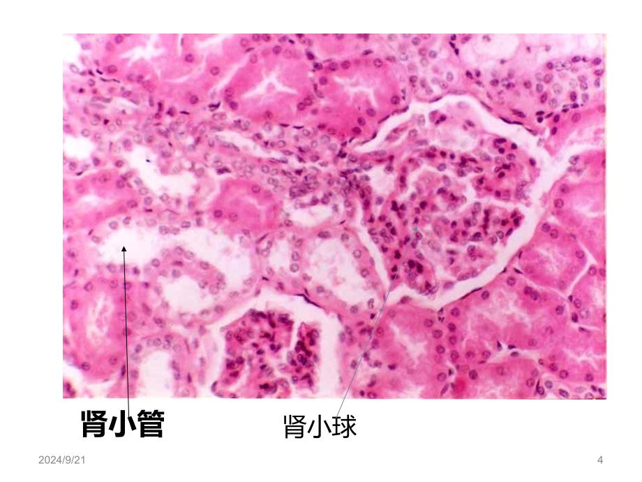 急性肾功能衰竭课件_第4页