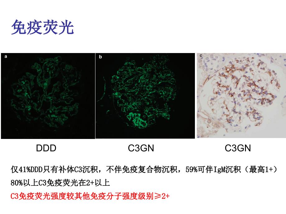 最新c3肾小球肾病 ppt课件PPT文档_第3页