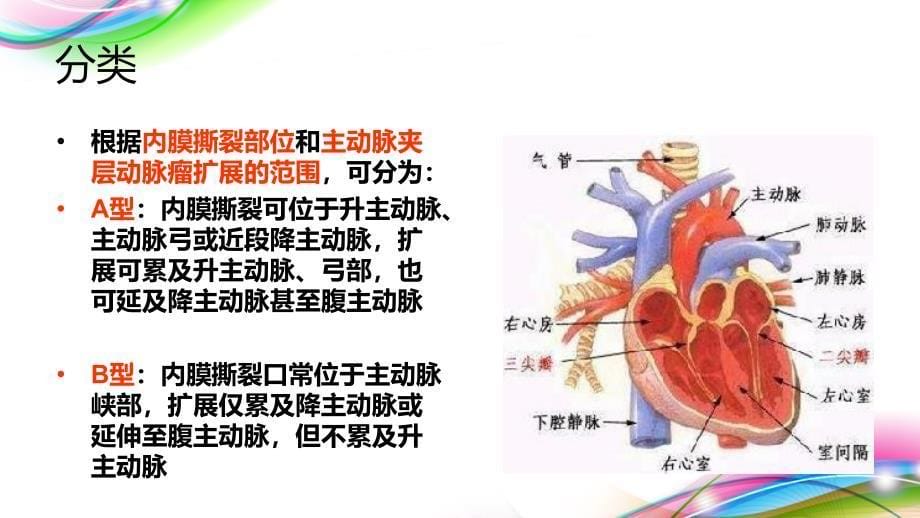 2016主动脉夹层护理查房.ppt_第5页