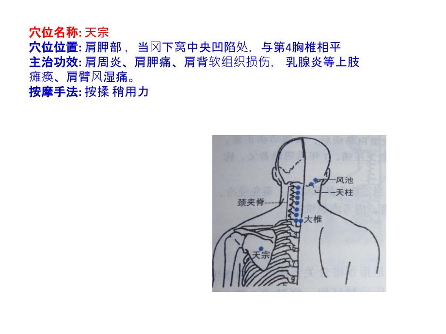 治疗颈椎病的穴位_第3页