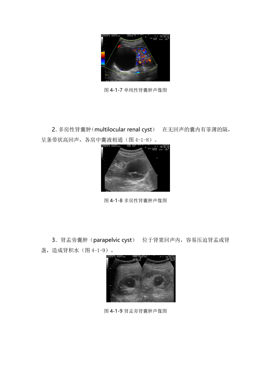 泌尿系统的超声常见病汇总_第5页