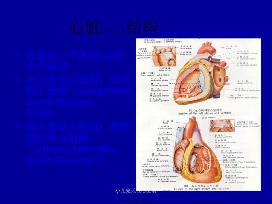 小儿先天性心脏病课件_第5页