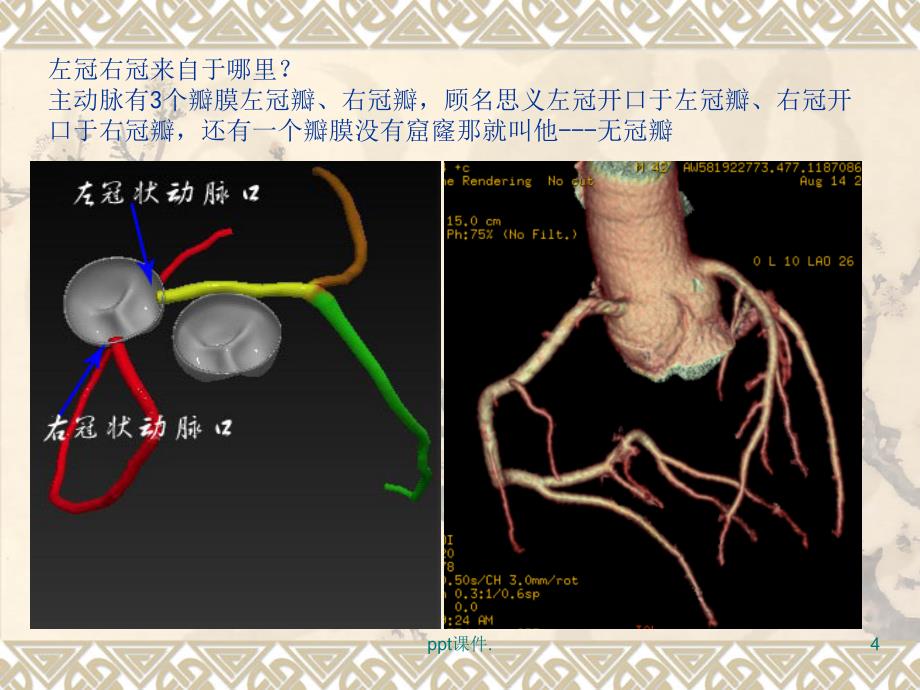 冠状动脉解剖ppt课件_第4页