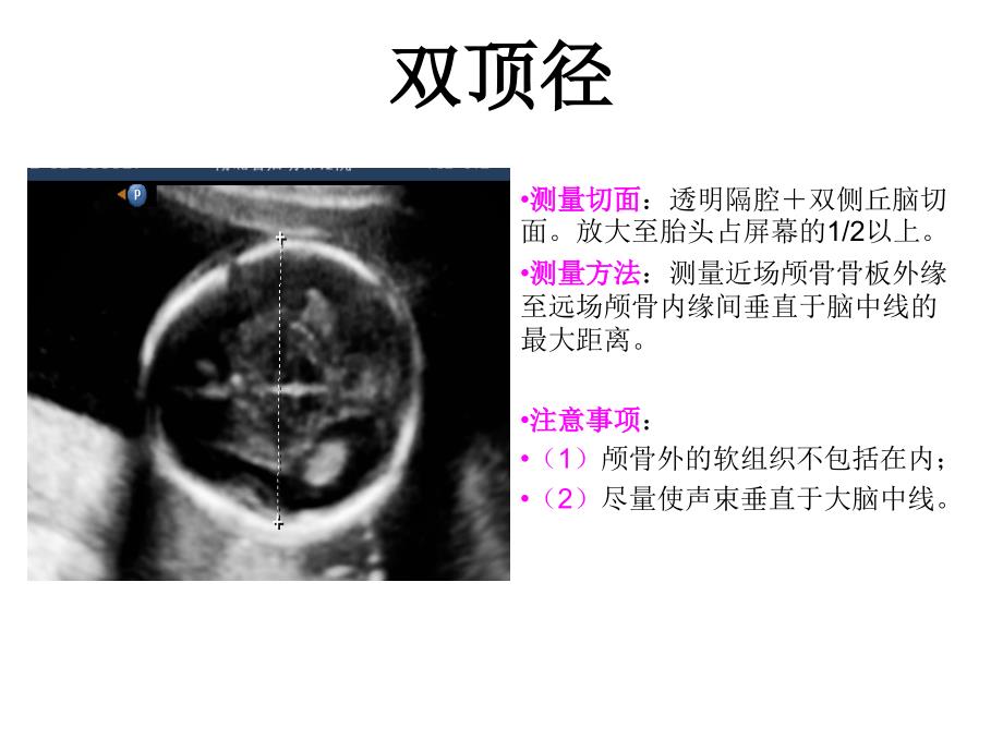 产科检查常规切面ppt课件_第3页