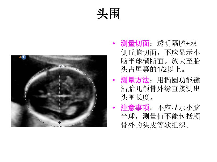 产科检查常规切面ppt课件_第4页