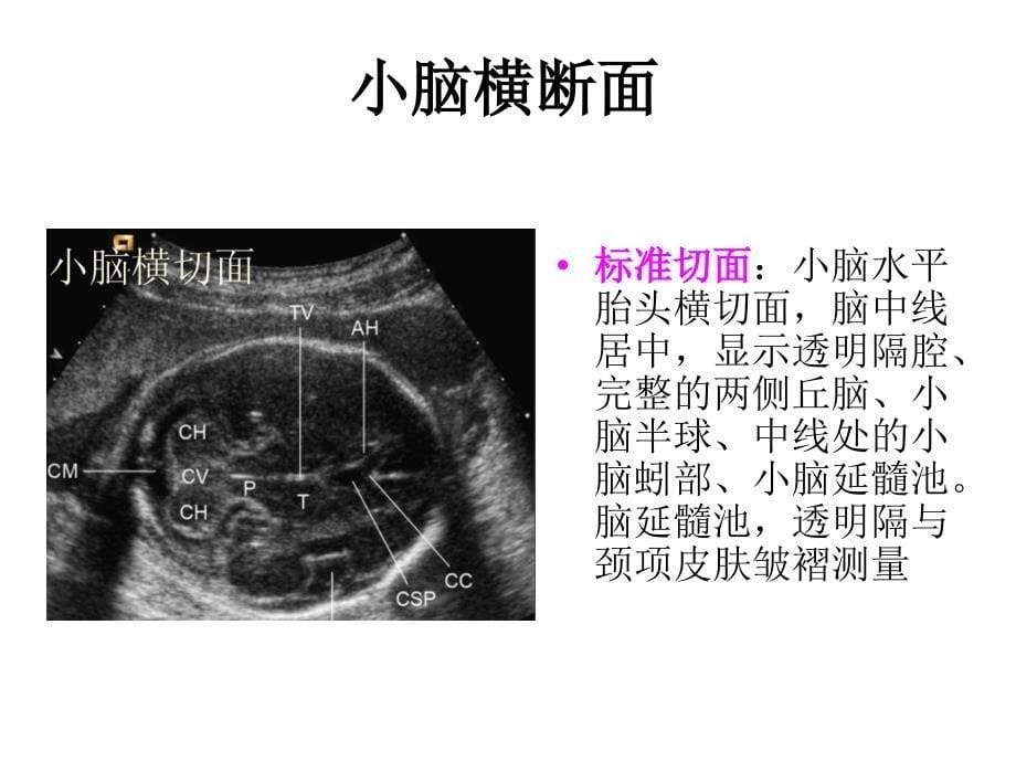 产科检查常规切面ppt课件_第5页