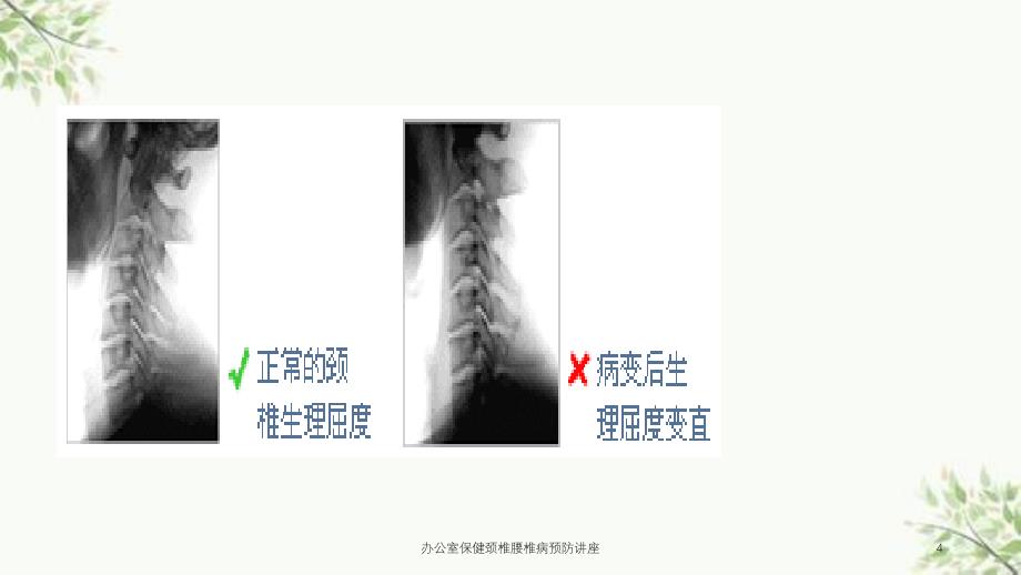 办公室保健颈椎腰椎病预防讲座课件_第4页