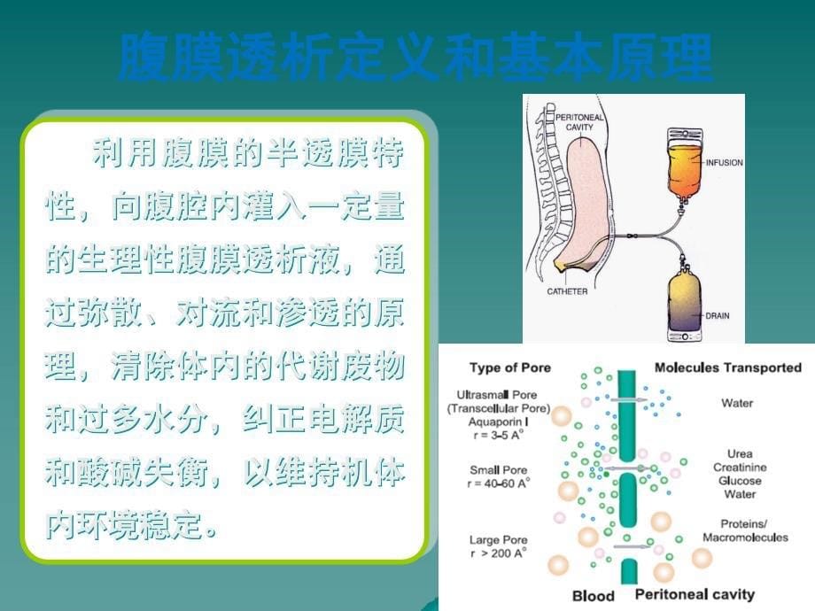 腹膜透析护理及新进展.ppt_第5页