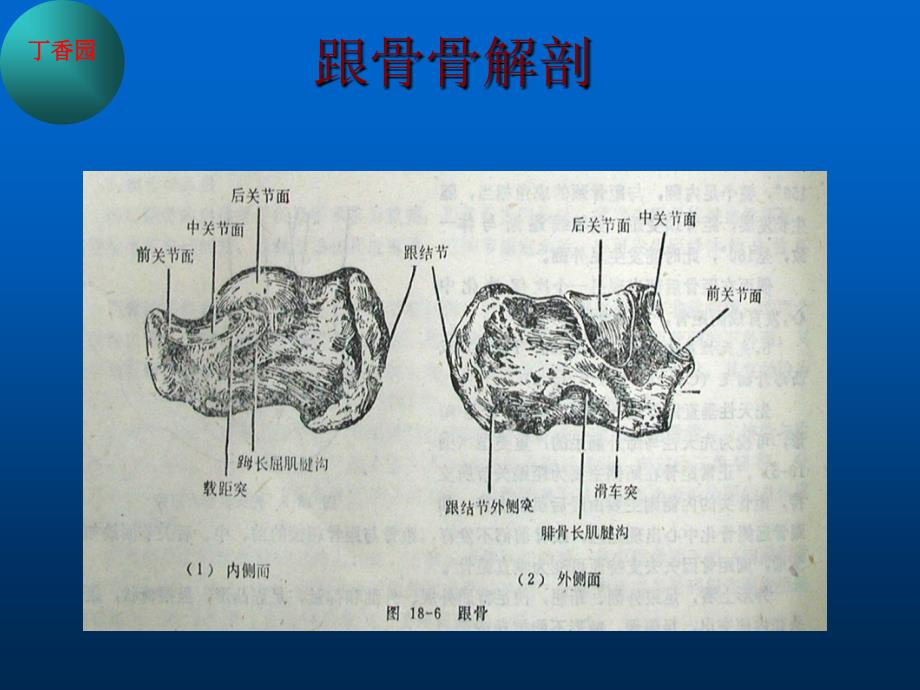 跟骨骨折的治疗_第3页