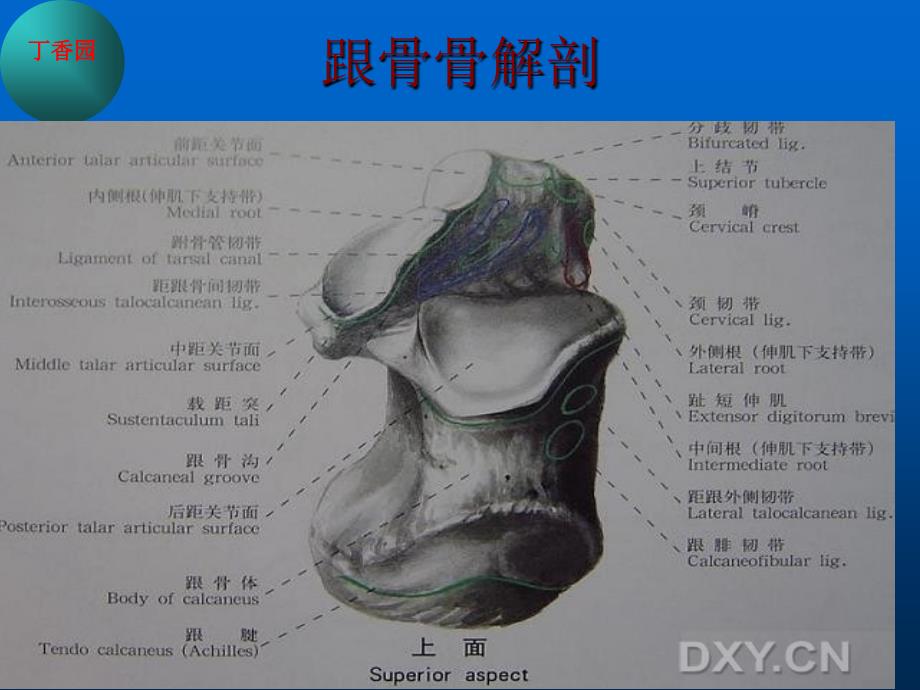 跟骨骨折的治疗_第4页