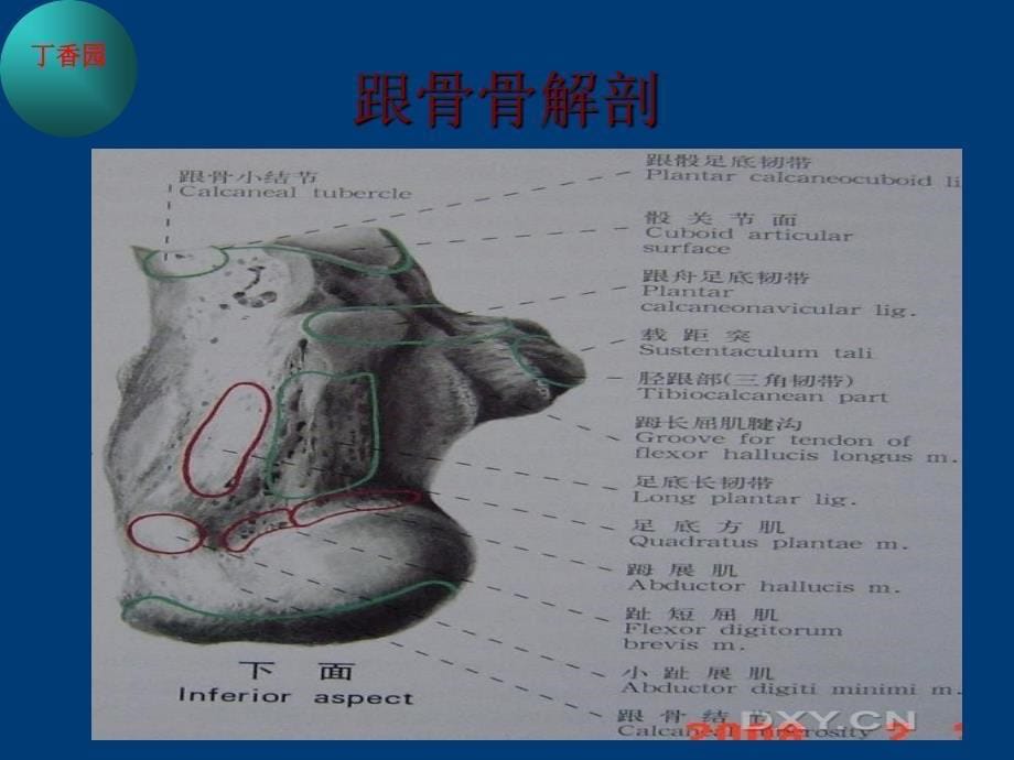 跟骨骨折的治疗_第5页