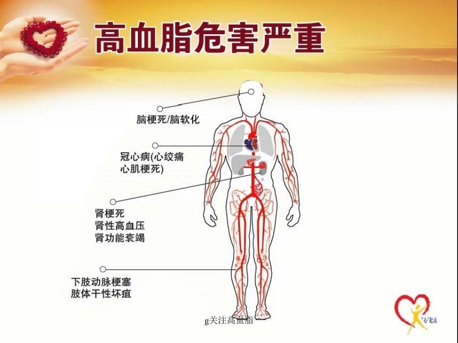 关注高血脂课件_第3页