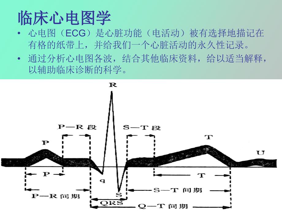 正常及异常心电_第1页