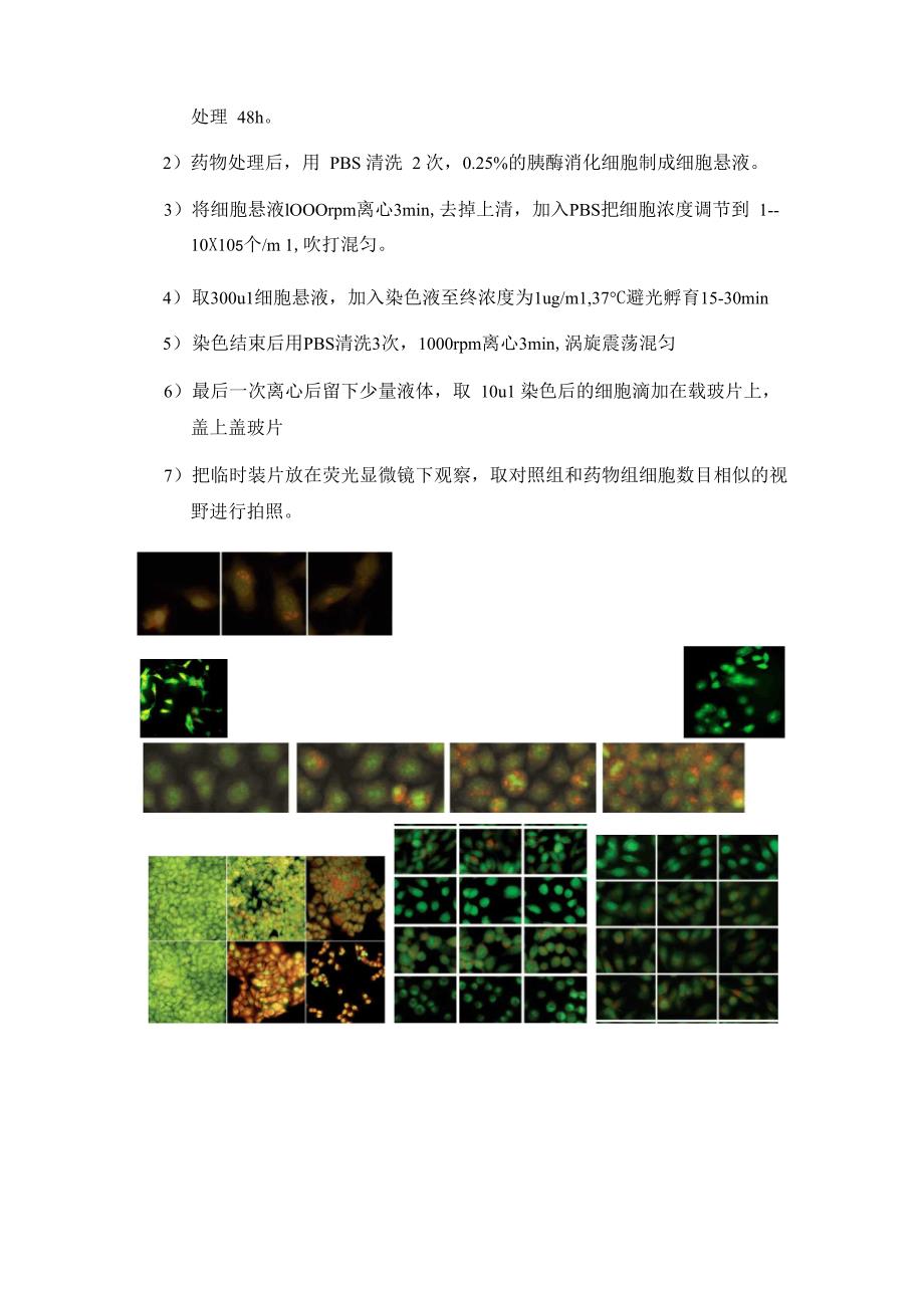 细胞自噬预实验_第2页