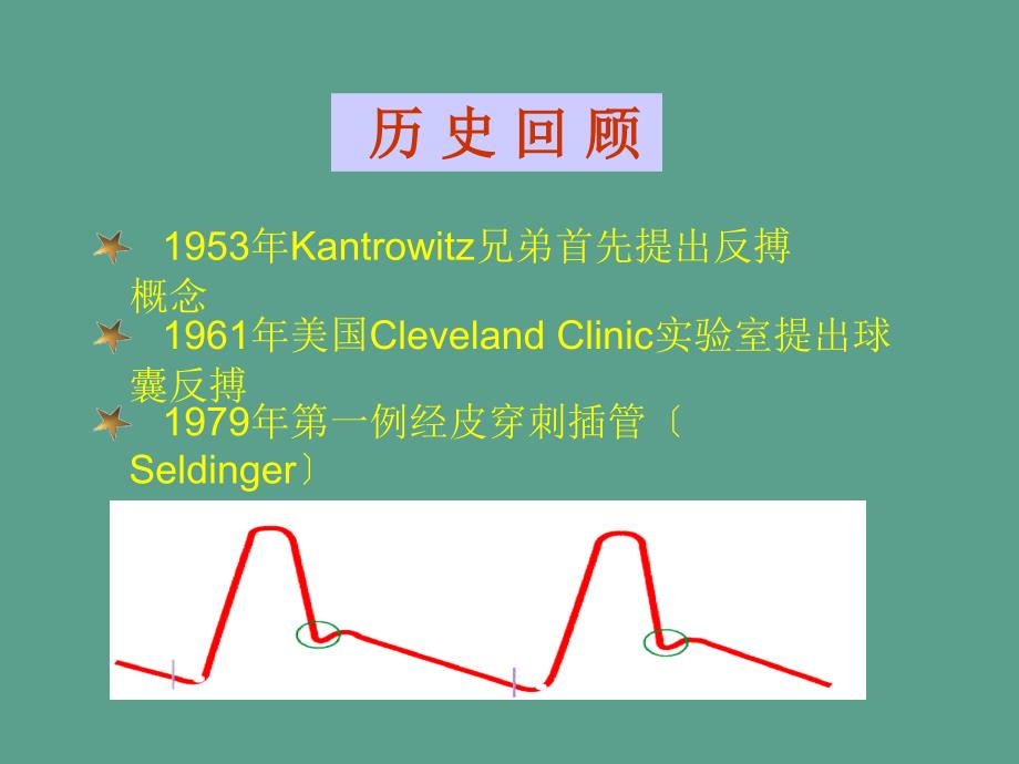 主动脉内球囊反搏泵ppt课件_第2页