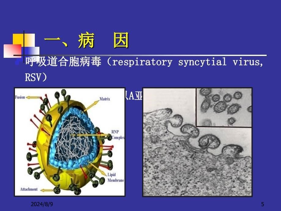 几种不同病原肺炎新模板_第5页