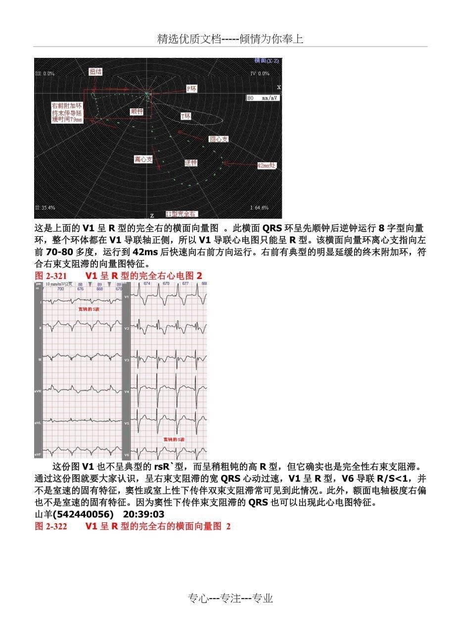 另类心电图讲义-10--心脏传导阻滞-室内传导阻滞(共25页)_第5页