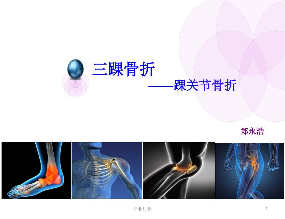 3三踝骨折【理论实操】_第1页
