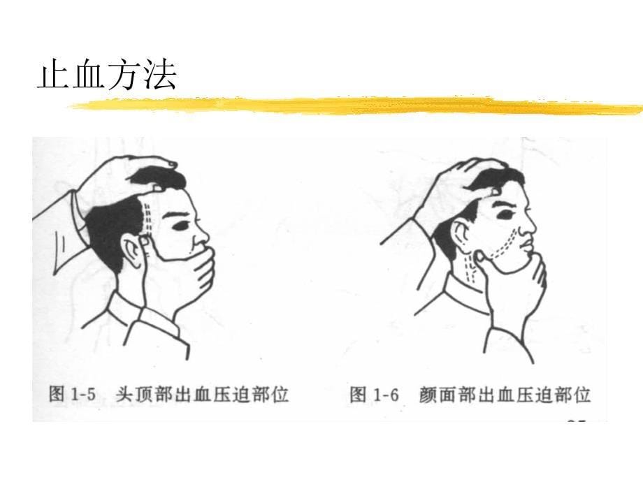 人体解剖生理学实验-急救技术_第5页