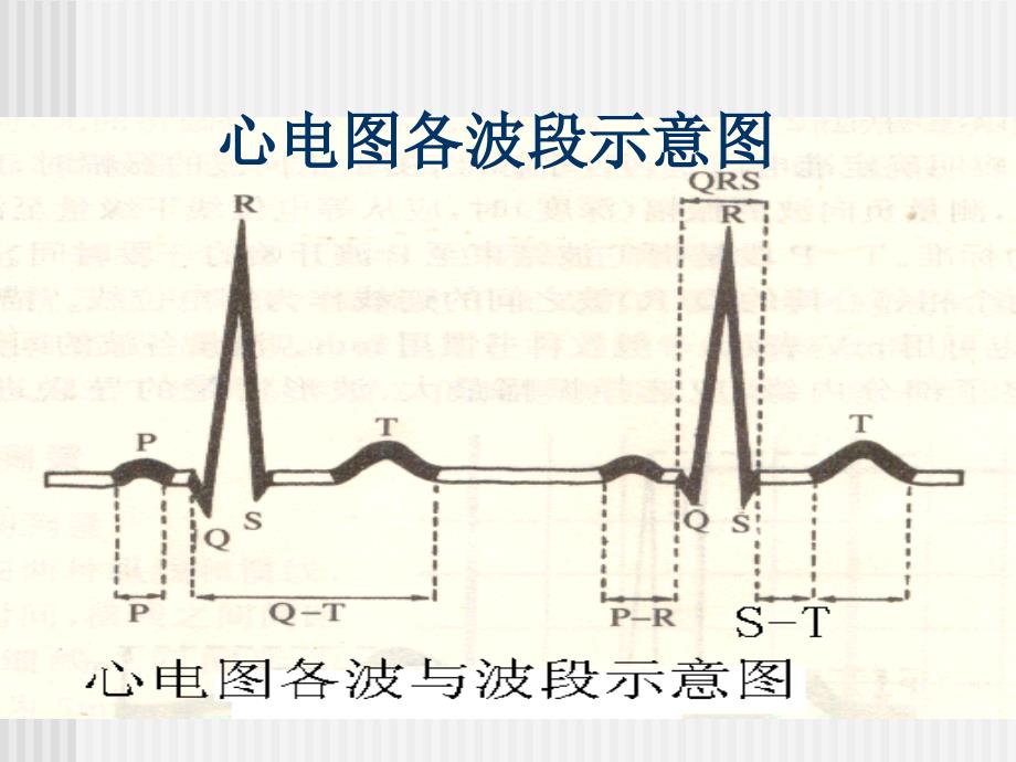 执业医师实践技能考试心电图培训_第2页