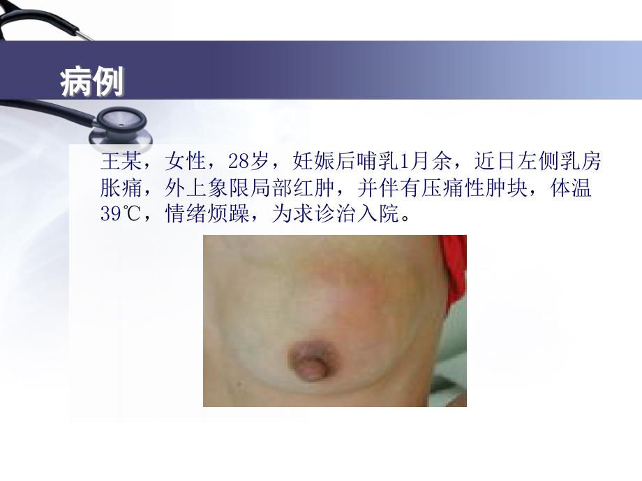 《急性乳腺炎》PPT课件.ppt_第3页