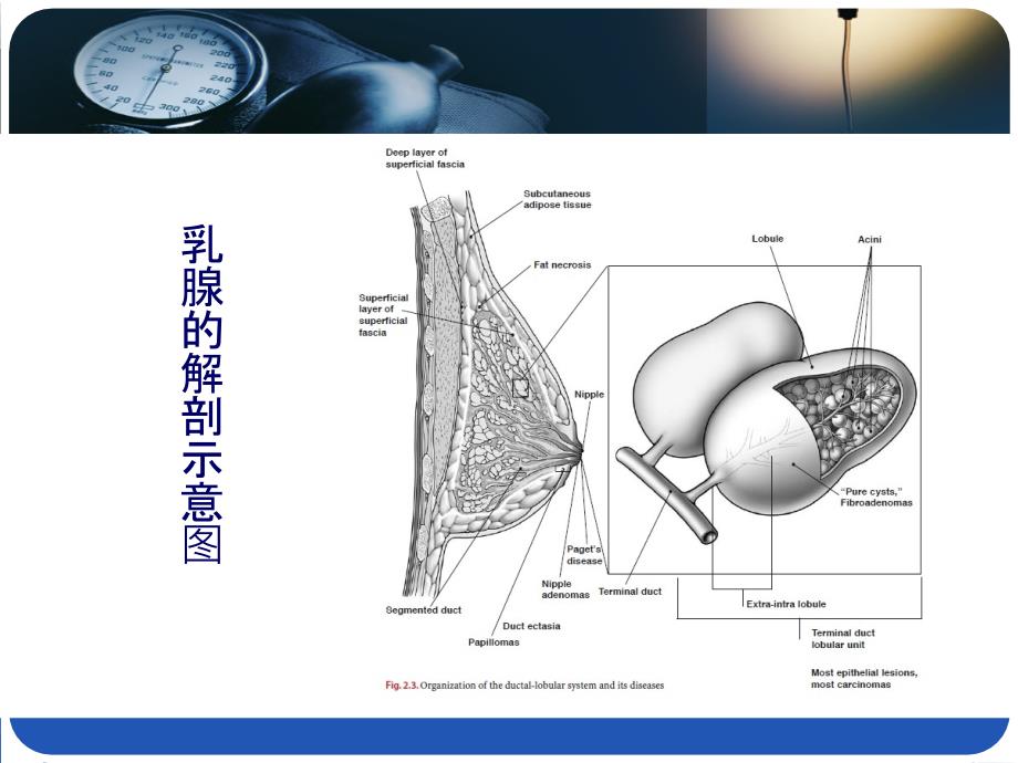 《急性乳腺炎》PPT课件.ppt_第4页