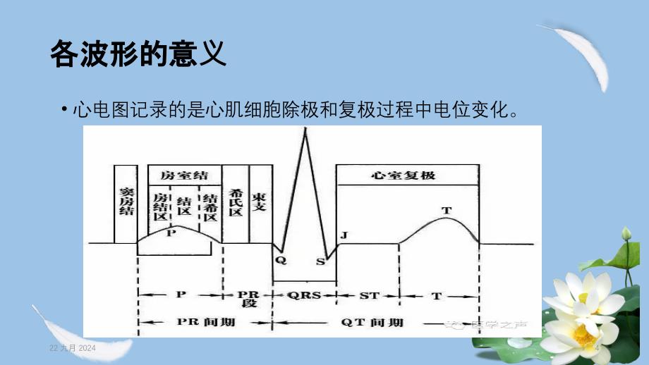 医学简简单单看懂心电图培训课件_第4页