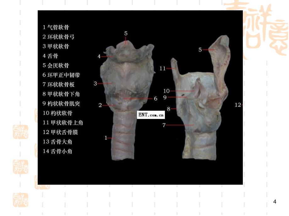 推荐精选环杓关节脱位_第4页