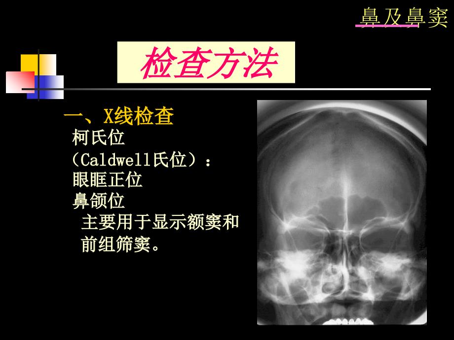 鼻及鼻窦影像诊断PPT课件_第4页