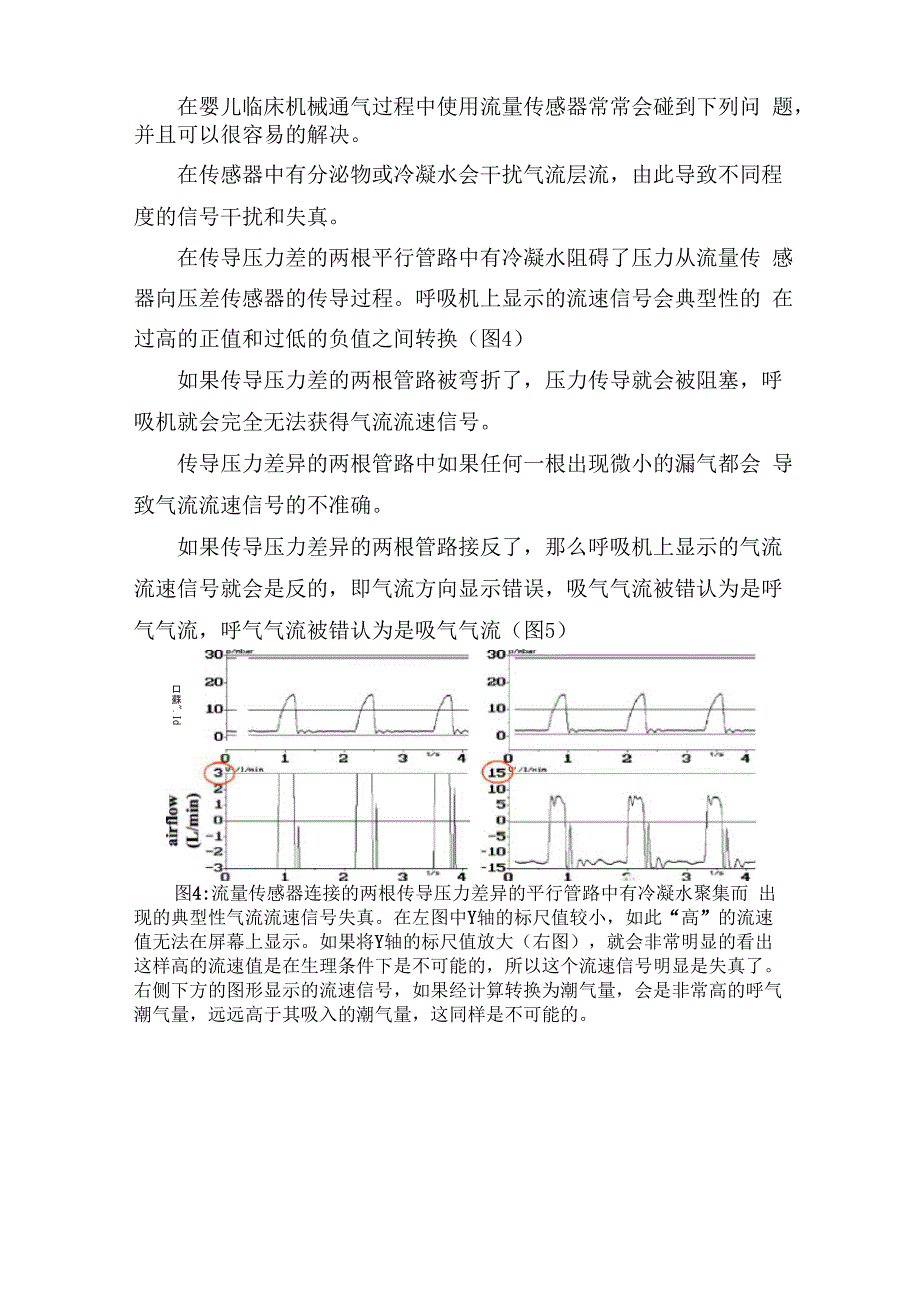 呼吸机压力、流速、潮气量测量、显示解读等机械通气知识总结_第4页