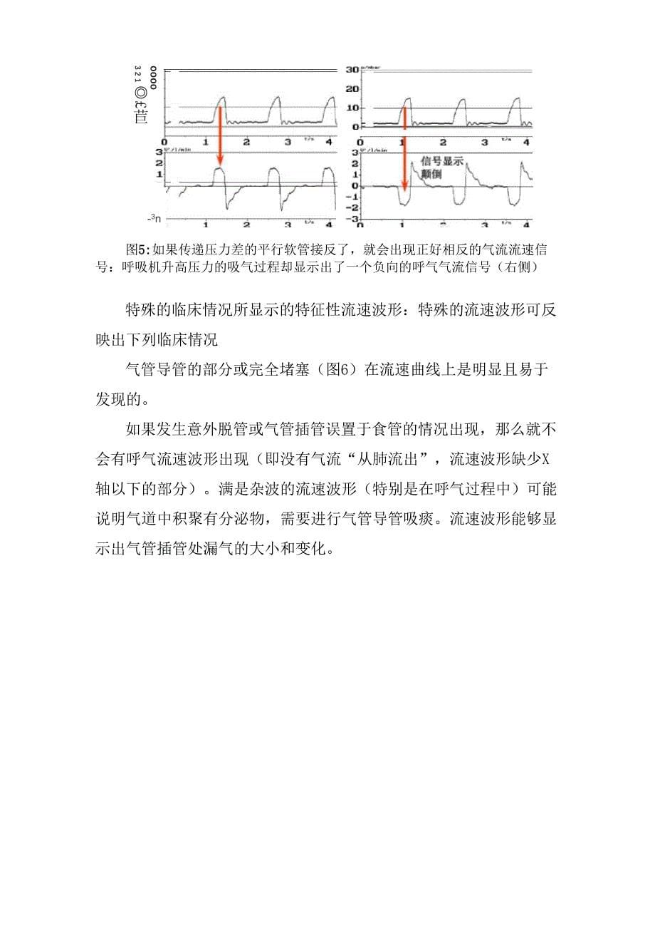 呼吸机压力、流速、潮气量测量、显示解读等机械通气知识总结_第5页