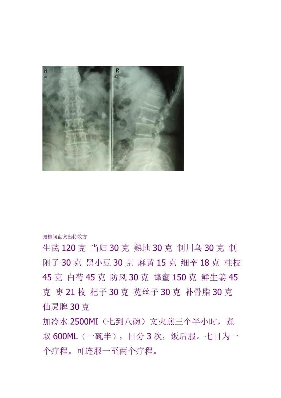 腰椎间盘突出特效方19548.doc_第5页