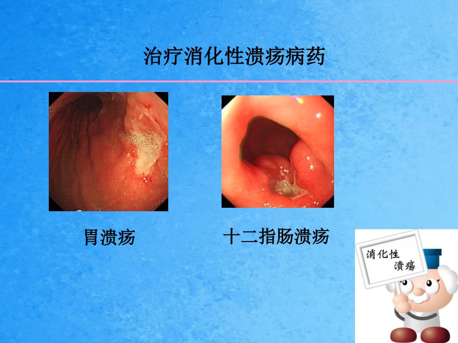 第二十六章作用于消化系统药物ppt课件_第4页