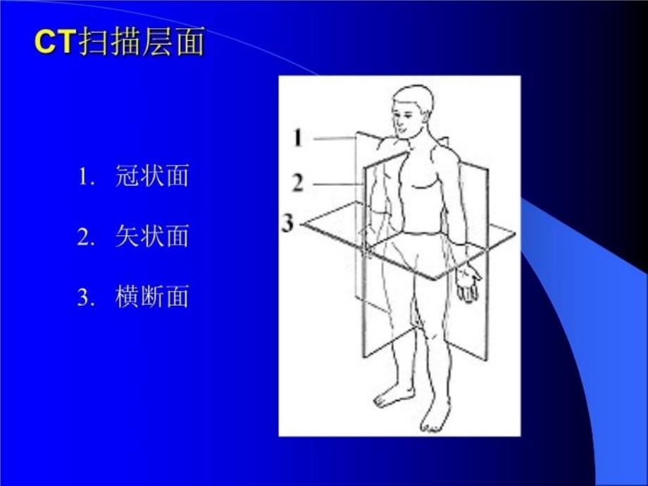 最新头颅CT课件ppt课件_第4页