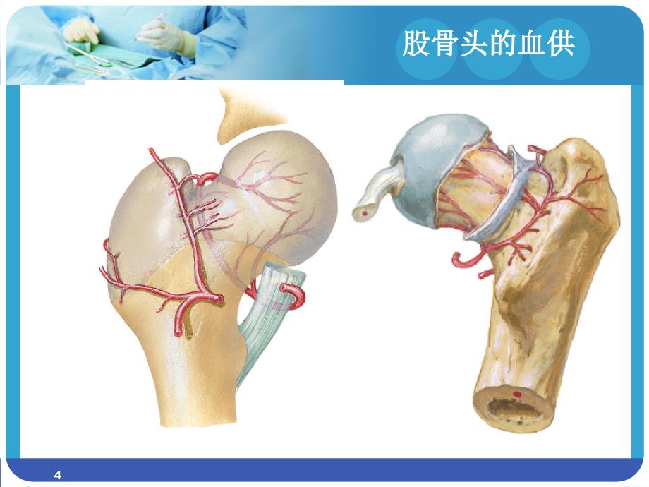 股骨颈骨折护理常规PPT参考课件_第4页