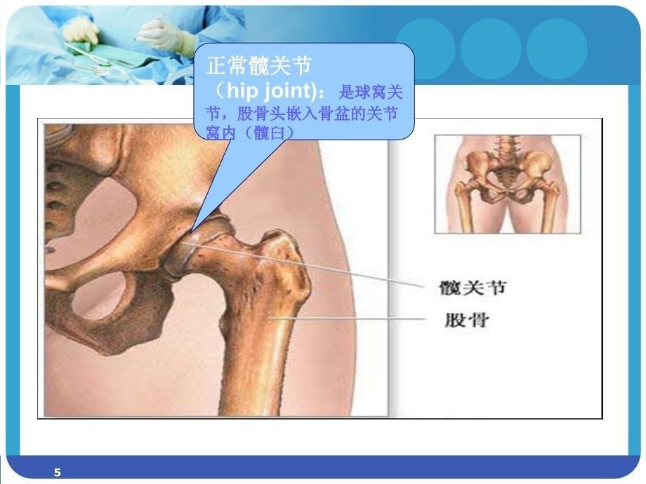 股骨颈骨折护理常规PPT参考课件_第5页