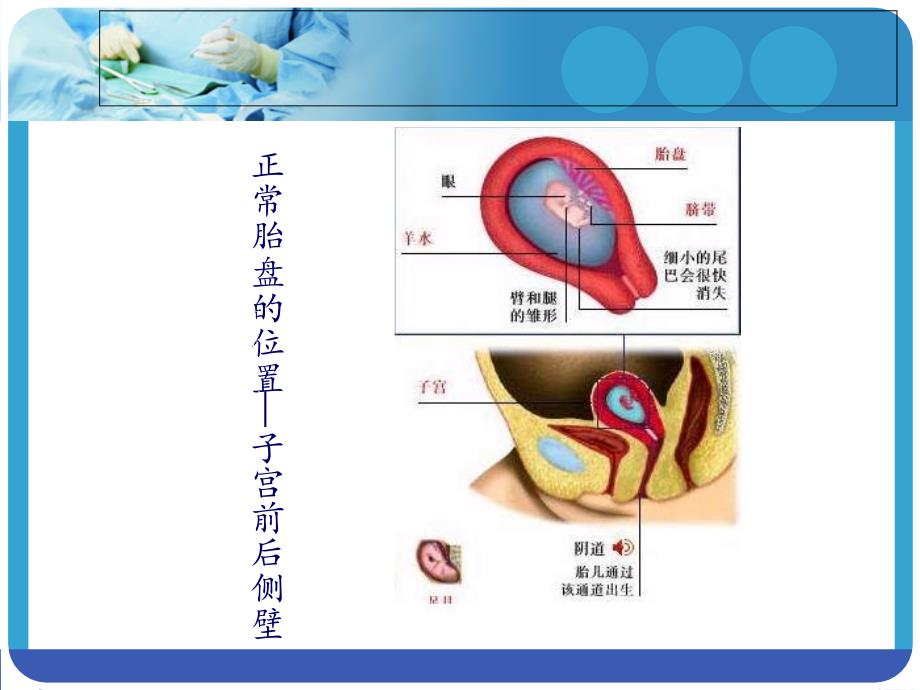 最新妇产科小讲课PPT_第3页