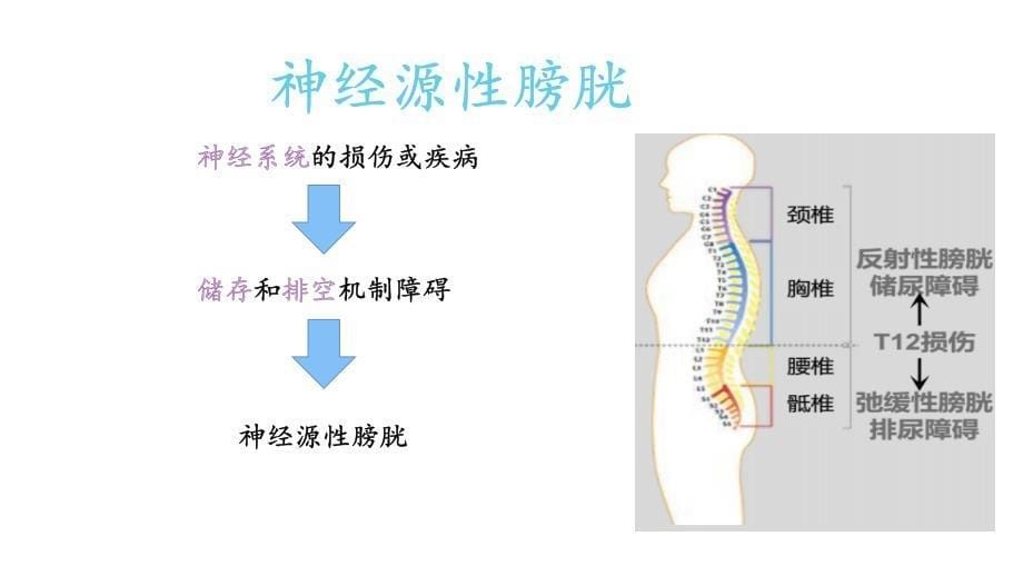 神经源膀胱病人的个案护理.ppt_第5页