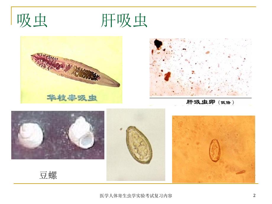 医学人体寄生虫学实验考试复习内容课件_第2页