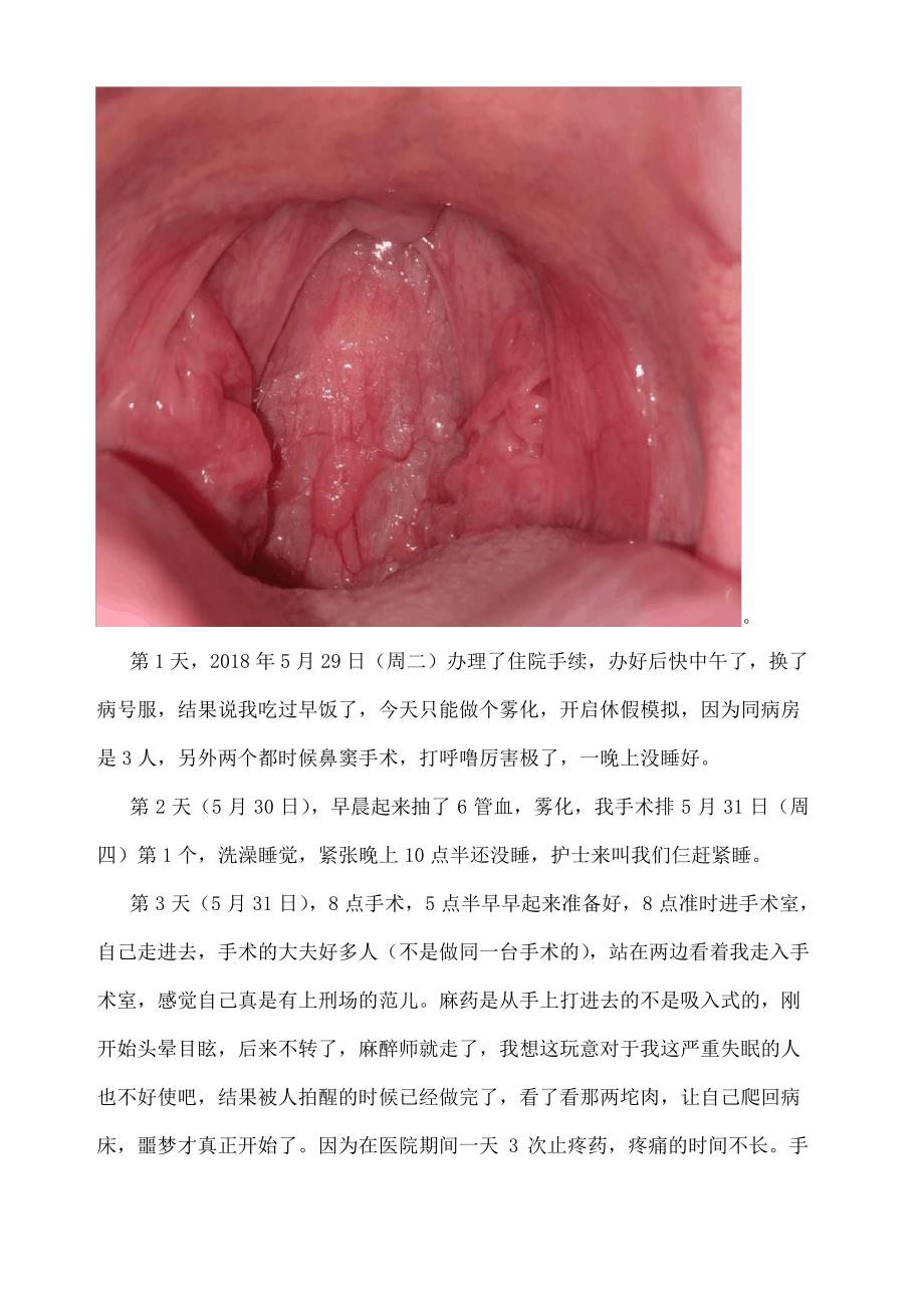 扁桃体切除手术 周日记_第2页