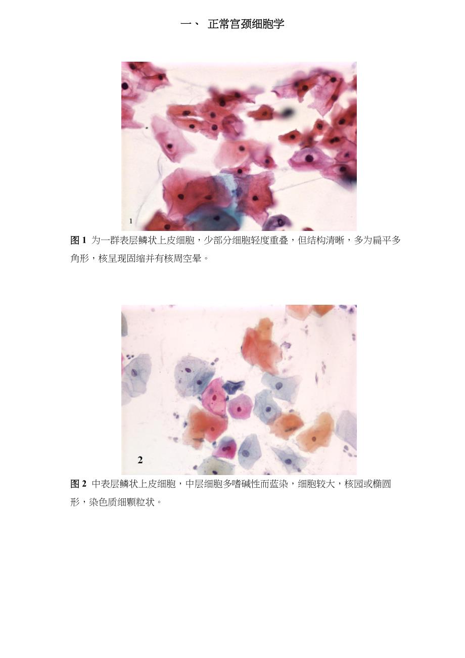 图谱宫颈细胞学(精品)_第1页