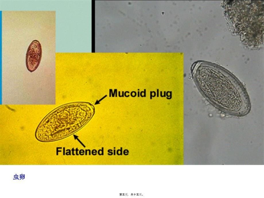 医学专题—第3讲---尖尾线虫病3033_第5页